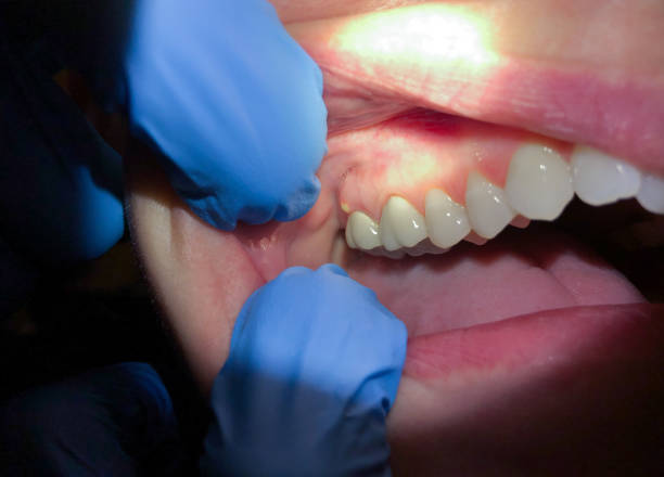 Best Pediatric Emergency Dentist in Stratford, NJ